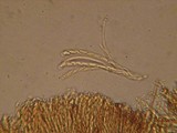 Hymenoscyphus imberbis image
