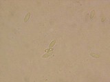 Hymenoscyphus imberbis image