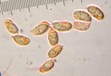 Cantharellus septentrionalis image