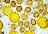 Octaviania tasmanica image