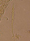 Bisporella pallescens image