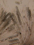 Pachyella babingtonii image