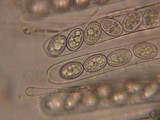 Pachyella babingtonii image