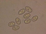 Pachyella babingtonii image