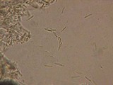 Lachnum clavigerum image