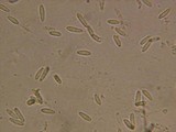 Phialina separabilis image