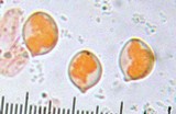Chrysomphalina strombodes image