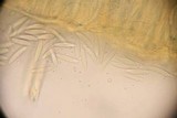 Tatraea macrospora image
