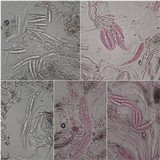 Schismatomma graphidioides image