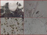 Enterographa hutchinsiae image