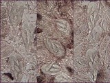 Arthonia cinnabarina image