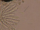 Mycosphaerella lineolata image
