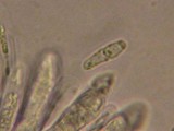 Mycosphaerella lineolata image