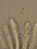Mycosphaerella lineolata image