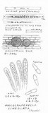 Mycosphaerella lineolata image