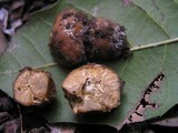 Tuber excavatum image