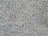 Schenella pityophila image