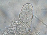 Hydnocystis piligera image