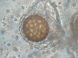 Tuber oligospermum image