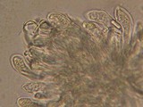 Pseudophacidium ledi image