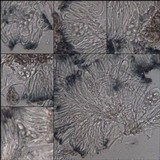 Lecidella elaeochroma f. elaeochroma image