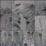 Lecidella elaeochroma f. elaeochroma image
