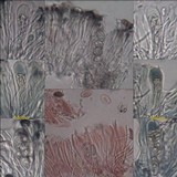 Lecidella stigmatea image
