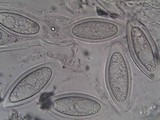 Pertusaria hymenea image