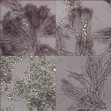Tephromela atra var. atra image