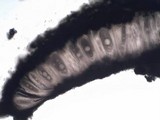 Pertusaria ophthalmiza image