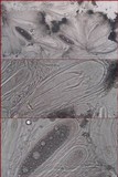 Pertusaria ophthalmiza image