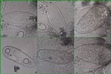 Pertusaria ophthalmiza image