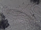 Pertusaria ophthalmiza image