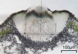 Cercidospora lobothalliae image