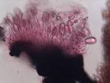Ascodichaena rugosa image