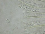 Peziza obtusapiculata image