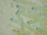 Peziza obtusapiculata image