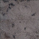 Lecidella elaeochroma f. elaeochroma image