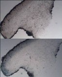 Protoblastenia cyclospora image