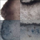Protoblastenia cyclospora image
