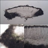Lecanora albella image