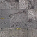 Lecanora albella image