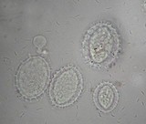Tuber guzmanii image