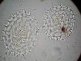 Tuber guzmanii image