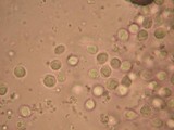 Amanita silvatica image
