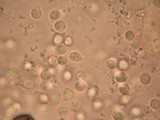 Amanita silvatica image