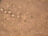 Amanita silvatica image