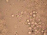 Amanita silvatica image