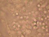 Amanita silvatica image