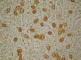 Gymnopilus subpurpuratus image